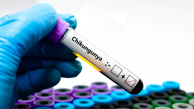 Çfarë është chikungunya? Simptomat dhe trajtimi