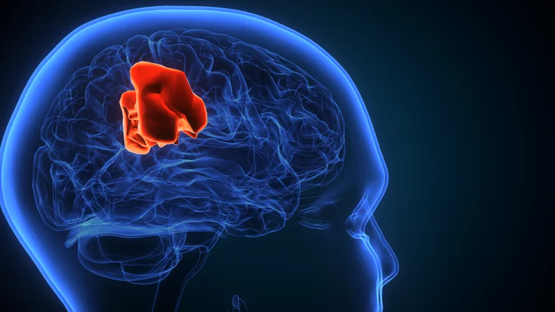 Çfarë është glioblastoma? Simptomat, diagnoza dhe trajtimi