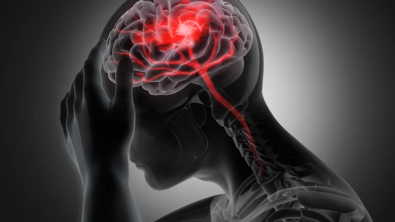 Çfarë është neuralgjia? Llojet, diagnoza dhe trajtimi