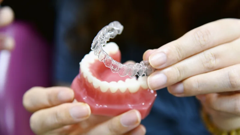 Çfarë është trajtimi ortodontik me aligner transparent?
