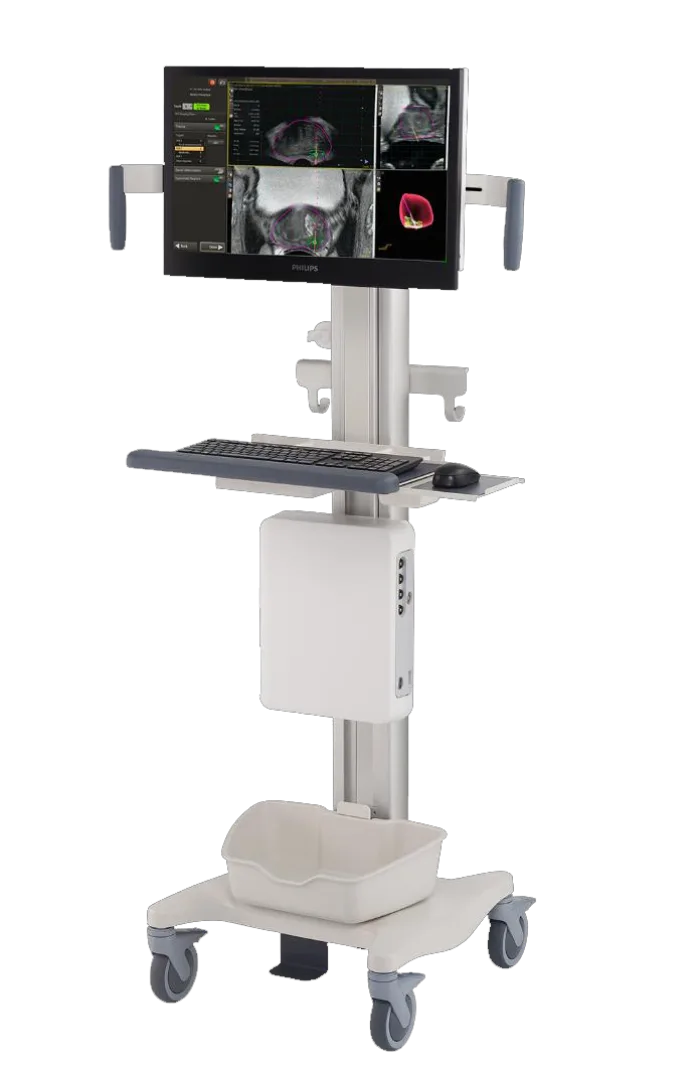 Biopsia MRI-Fusion